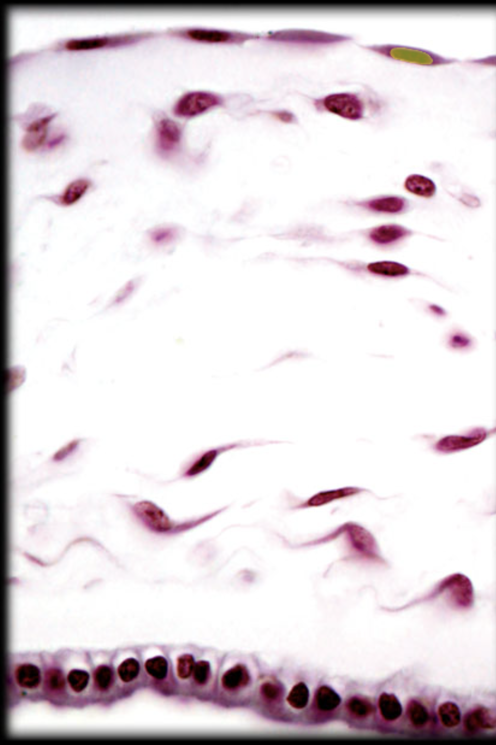 <p>Nucleus of squamous cell</p>