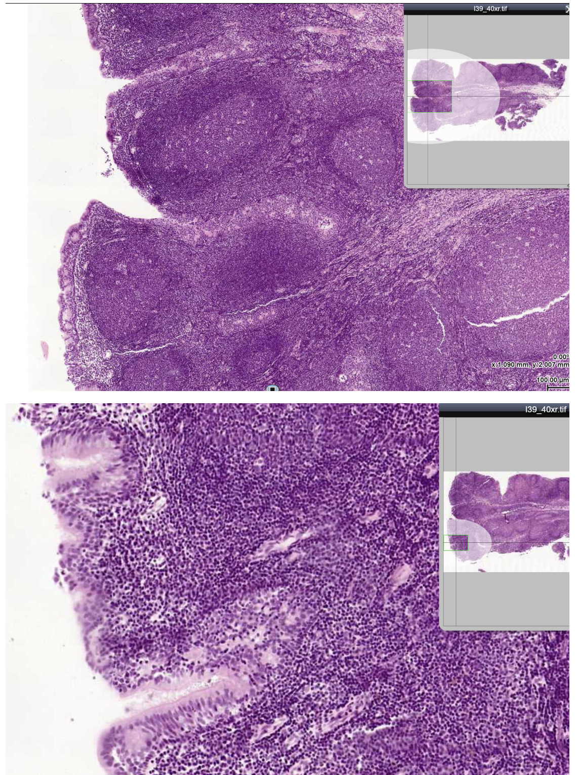 <p><span><span>The tissue shown in the linked image is best described by which of the following?</span></span></p>