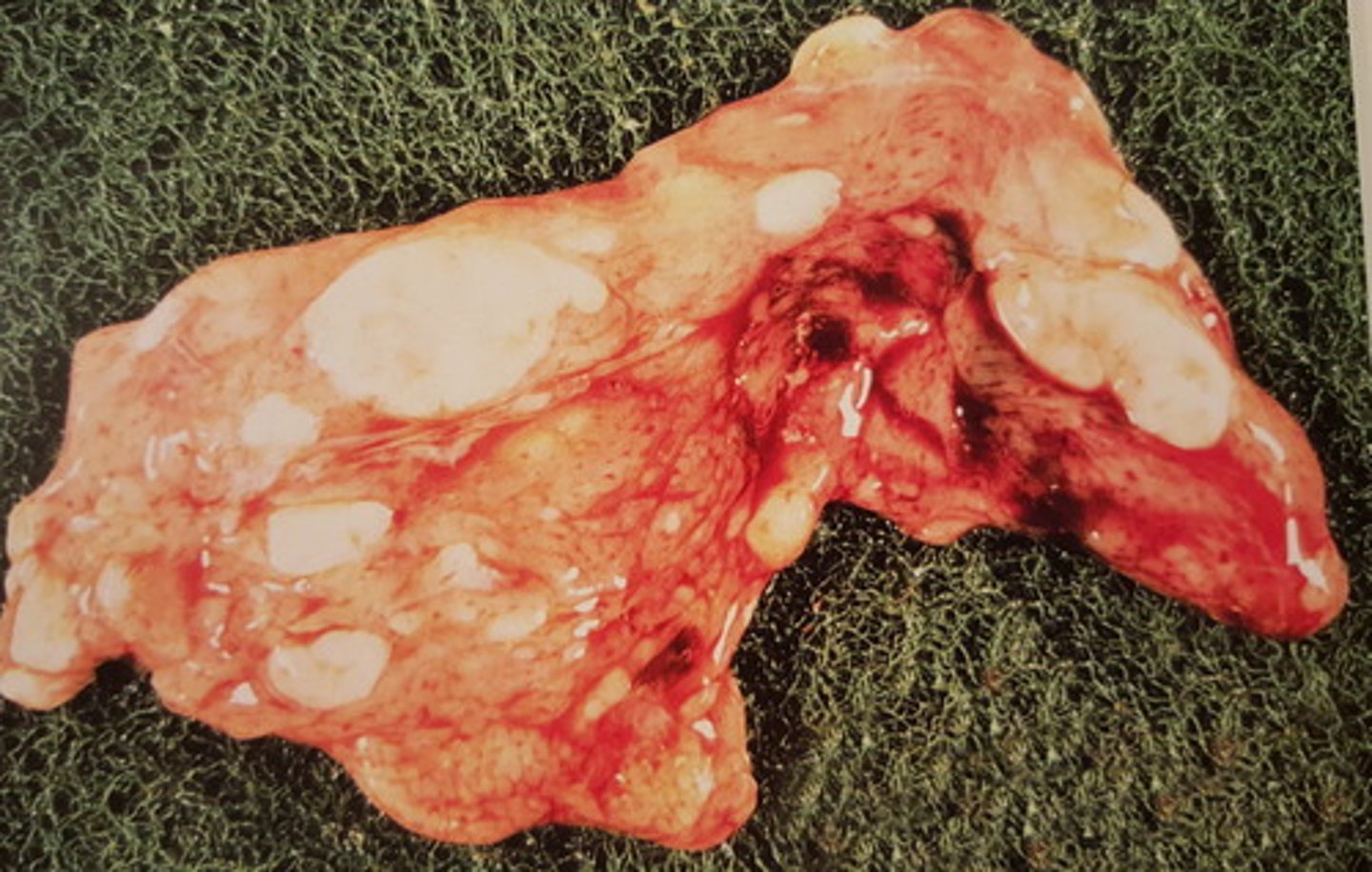 <p>Pancreas fra okse. Patoanatomisk diagnose?</p>
