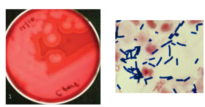<p>lets say you saw this on your ABAP, there was no growth on the LKV, and gram stained and saw GPB, what organism would this be </p>