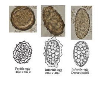 <p><em>Ascaris lumbricoides</em></p>