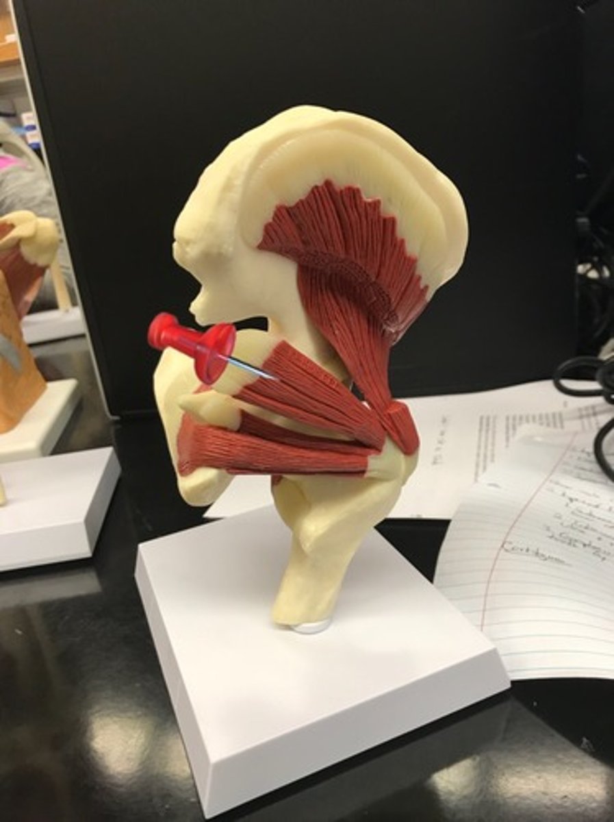 <p>origin: sacrum, ilium, sacroiliac joint<br>insertion: femur, greater trochanter<br>action: lateral rotation at the hip</p>