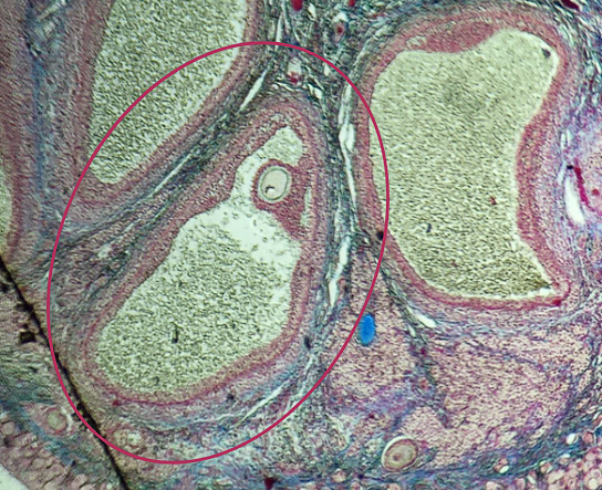 <p>What term describes the structure consisting of the remnants of the ruptured encircled structure after ovulation?</p>