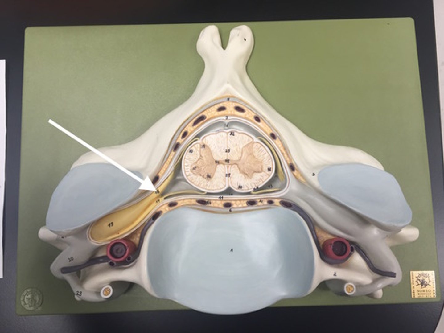 <p>Name this structure</p>