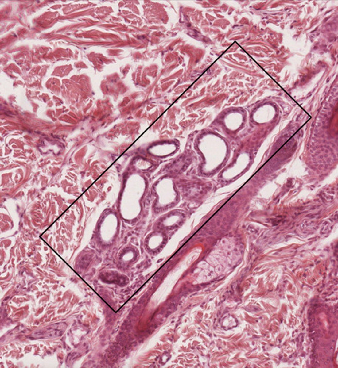 <p>What type of gland is located within the black box?</p><p>What type of epithelium surrounds this gland?</p><p>What organ is this from?</p>