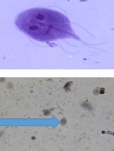 <p>MOT: Fecal/oral - ingestion of cyst</p><p>Infective Stage: Cyst</p><p>Hosts: Humans & other animals</p><p>Parts to look for: Heart-shaped, flagella, two nuclei, organelles positioned in a way that looks like a face</p>