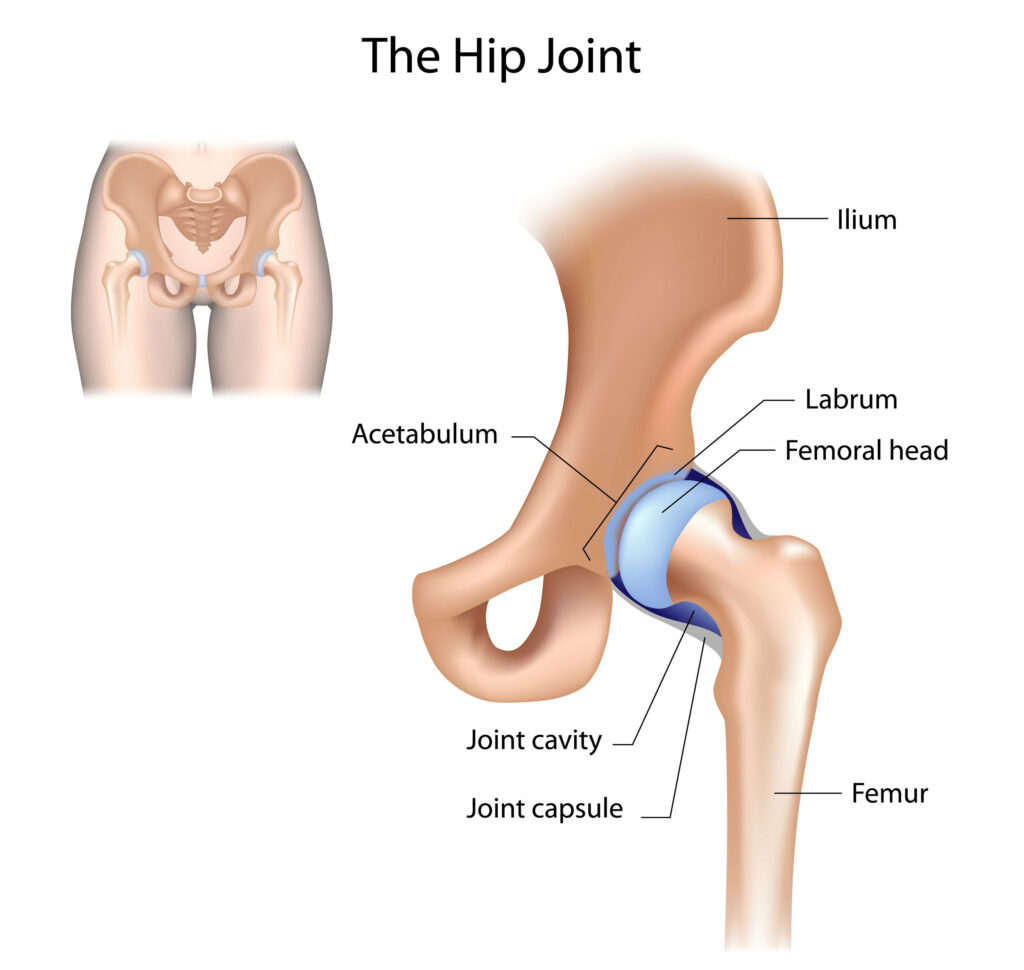 <p>In the<em> Hip joint</em>, the convex <strong>femoral head</strong> moves on the concave <strong>acetabulum</strong>, the roll and glide occur in ________ directions.</p>