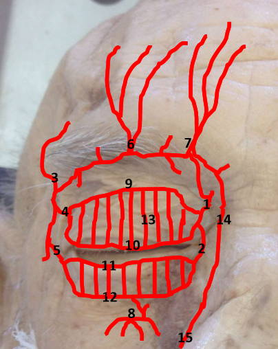 <p>What are these arteries?</p>