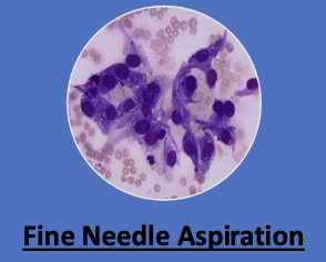 <p>not really, has low diagnostic yield</p><p>-can also hemodilute sample</p><p>-may also increase bleeding risk</p>