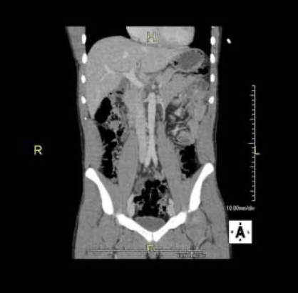 <p>Which CT view?</p>