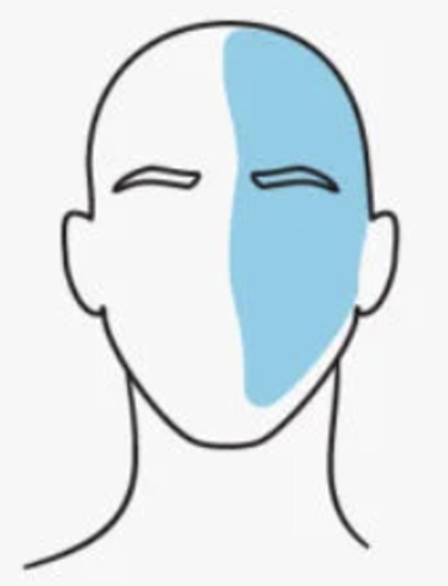 <p>present before or at onset. neurological manifestations include:</p><p>- visual</p><p>- sensory</p><p>- speech</p><p>- motor</p><p>- should be considered w or w/o HA if at least one of these develops over 5 minutes, lasts 5-60 min and resolves fully</p>