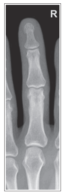 <p>What’s wrong with this oblique finger? </p>