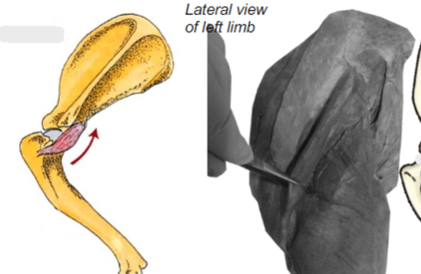 <p>Insertion of teres minor:</p>