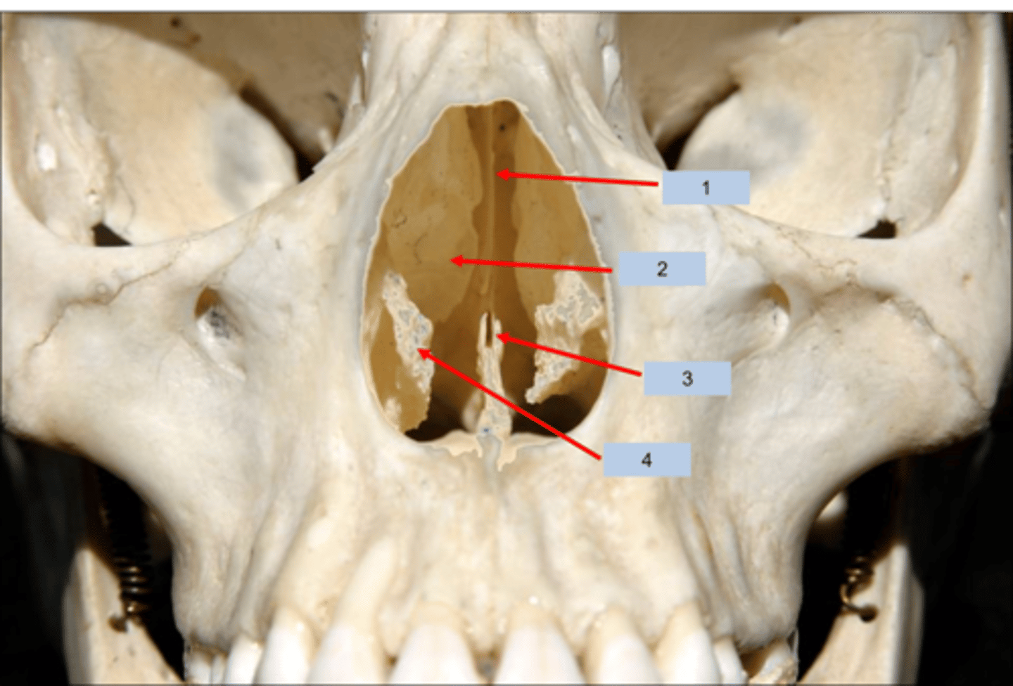 <p>What is #4 pointing to?</p>