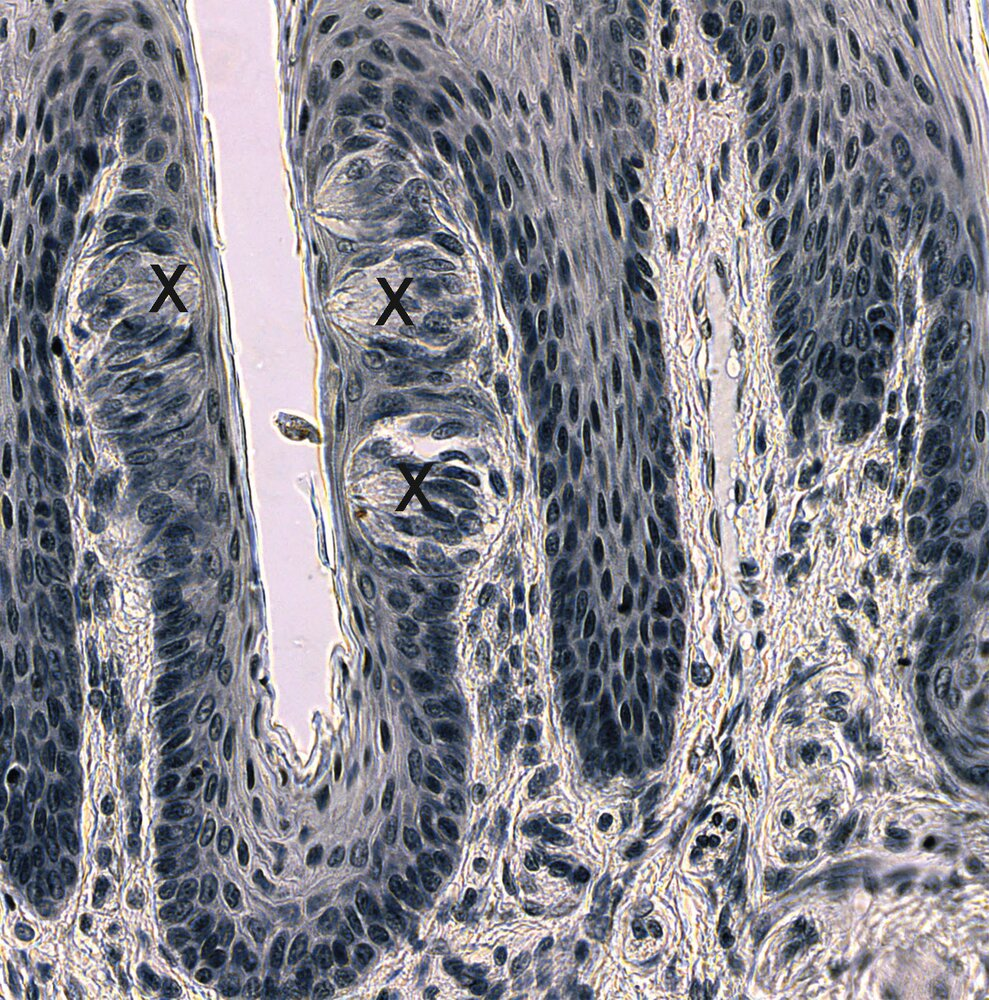 <p>11. The structures marked with X in the image:</p><p>A. Are involved in the sense of smell (olfaction)</p><p>B. Contain microvilli</p><p>C. Are typical of the squamous epithelium of the vagina</p><p>D. Are surrounded by respiratory epithelium</p><p>E. Are innervated by spinal nerves</p>