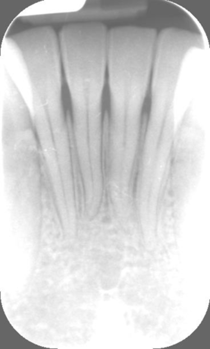 <p>What is this error?</p>