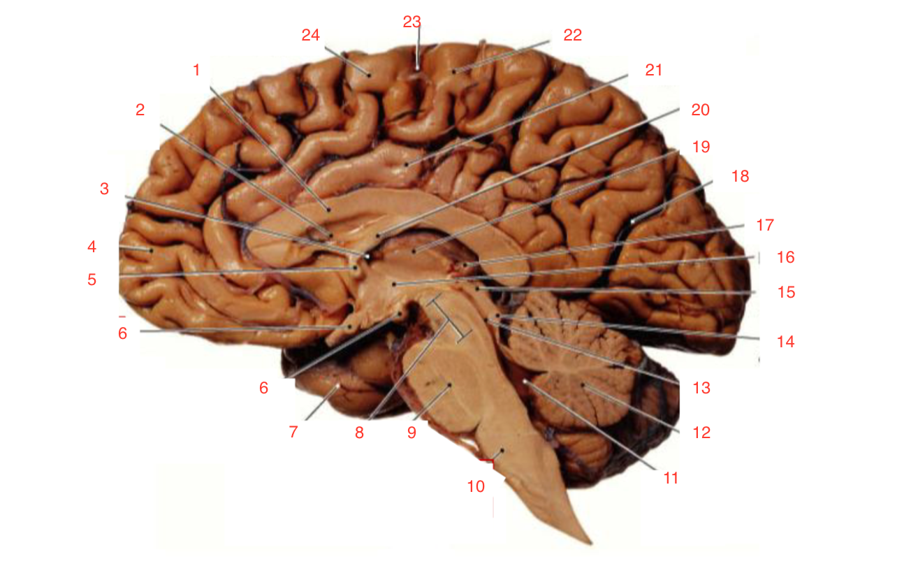 <p>optic chiasm</p>