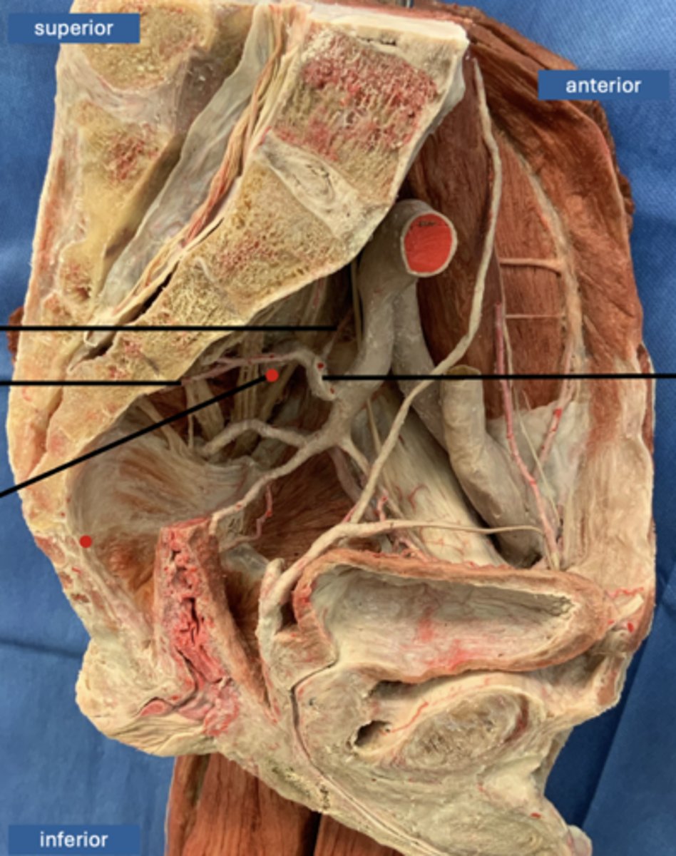 <p>artery</p>