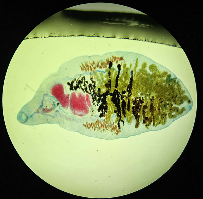 <p><span data-name="microscope" data-type="emoji">🔬</span><span data-name="petri_dish" data-type="emoji">🧫</span><strong><span> </span>Na podstawie zdjęcia preparatu:</strong></p><p></p><ul><li><p><span data-name="book" data-type="emoji">📖</span><span> </span>rozpoznaj gatunek pasożyta;</p></li></ul><p></p><ul><li><p><span data-name="recycle" data-type="emoji">♻</span><span> </span>rozpoznaj wszystkie formy rozwojowe;</p></li></ul><p></p><ul><li><p><span data-name="microbe" data-type="emoji">🦠</span><span> </span>wskaż organelle i cechy charakterystyczne dla danego gatunku;</p></li></ul><p></p><ul><li><p><span data-name="mask" data-type="emoji">😷</span><span> </span>nazwij chorobę, którą pasożyt wywołuje.</p></li></ul><p></p>