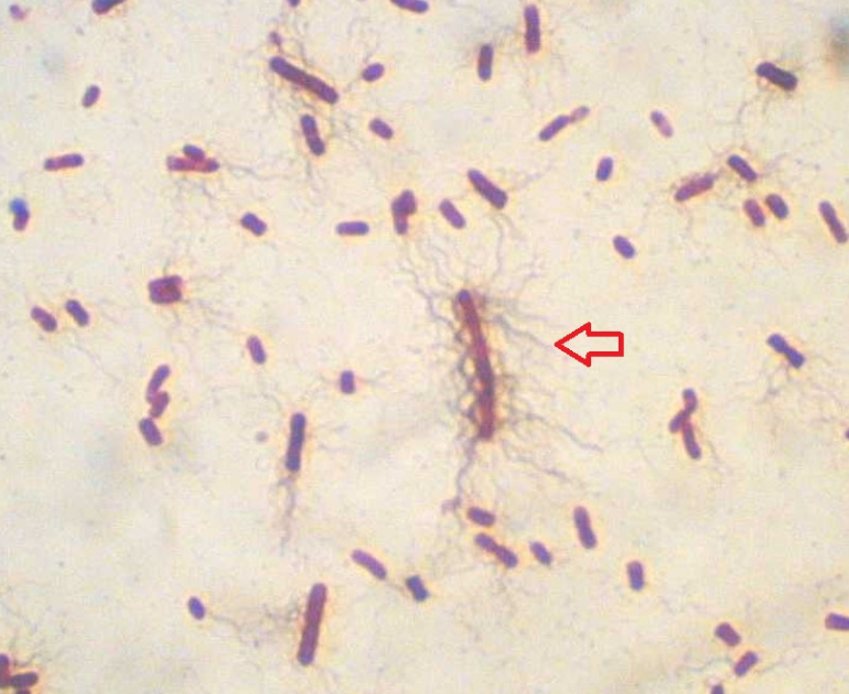 <p>Type of flagella</p>