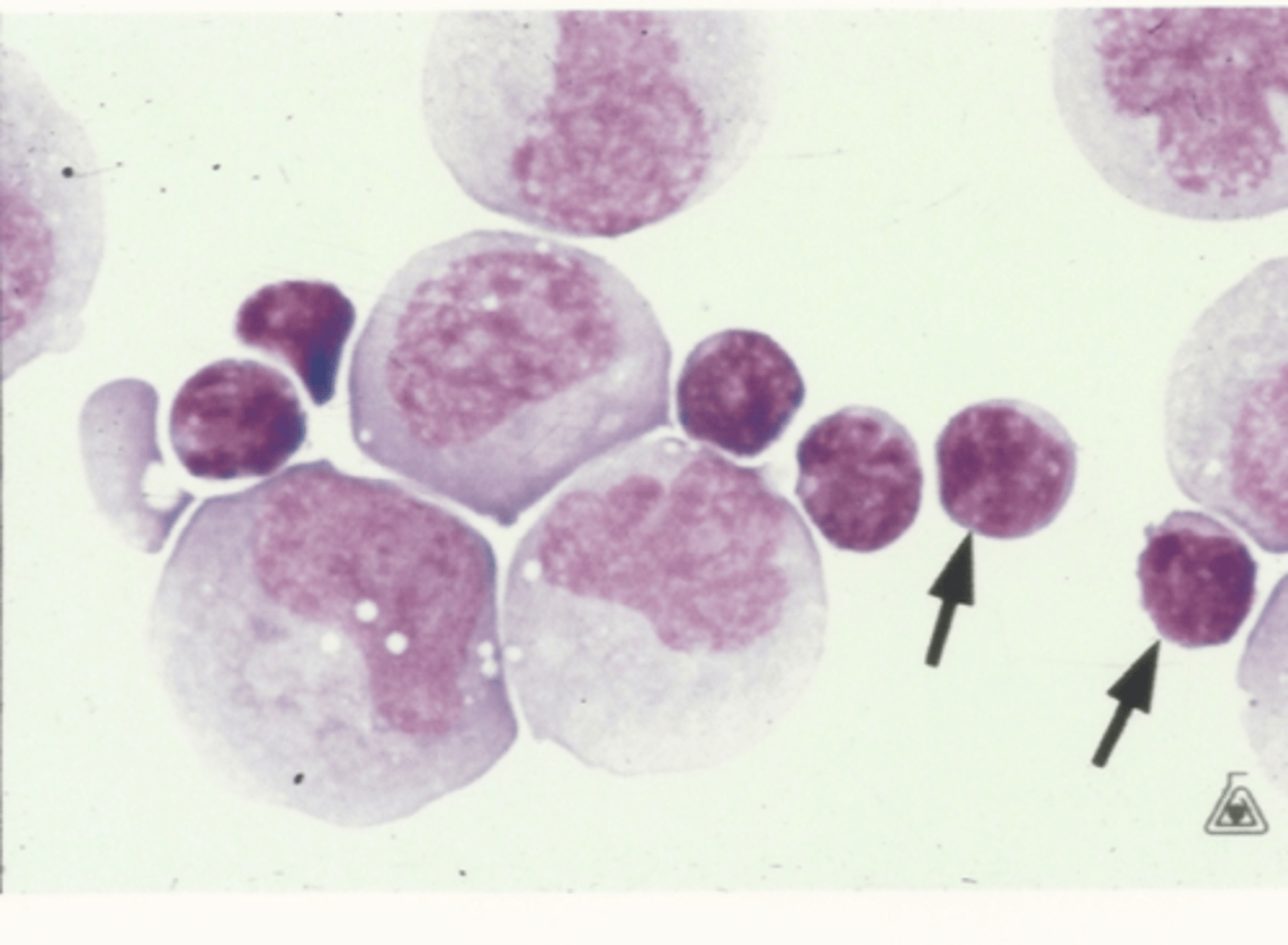 <p>Identify the cells in this body fluid</p>