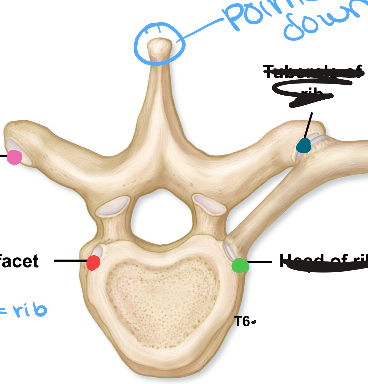 <p>What is the blue protrusion?</p>