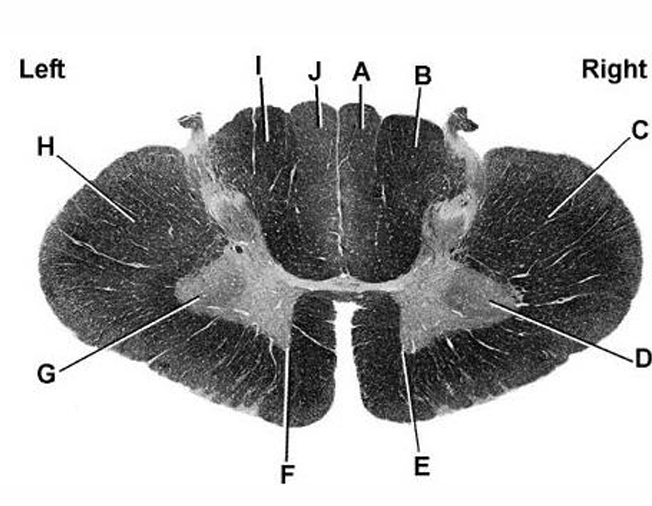 <p>cervical, thoracic, lumbar, or sacral?</p>