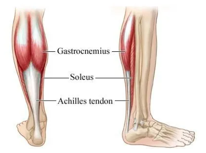 <p>The soleus is a muscle located in the calf of the leg.</p>