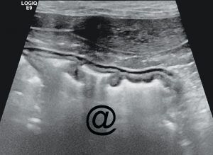 <p><span>US of a normal feline abdomen (below), probe placed on the ventral abdomen, just caudal to the rib cage and to the right of midline. What is the structure/region labeled </span><strong>@</strong><span>?</span></p>