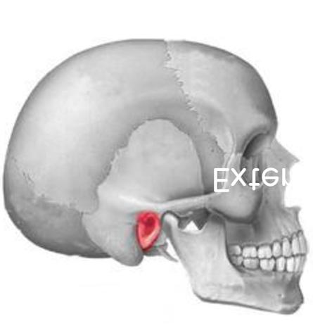 term image