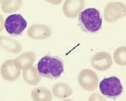 <p>what is it, what is arrow pointing at</p>