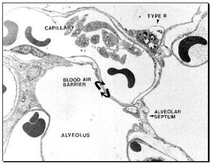 <ol><li><p>Alveoli</p><ul><li><p>Afbraak van alveolaire septa → <strong><u>verminderd alveolo-capillair oppervlak</u></strong></p></li><li><p>Minder contact bloed-gas → discrete hypoxemie, ventilatie-perfusie-mismatch</p></li><li><p>Gasuitwisseling meestal voldoende in rust, minder bij inspanning</p></li></ul></li><li><p>Longelasticiteit</p><ul><li><p><strong><u>Stijfheid longweefsel</u></strong></p><ul><li><p>door vorming van verbindingen tussen de collageenmoleculen en de elastinemolecule</p></li><li><p>Toename oppervlaktespanning door verandering in surfactant (moleculen die uitzetten en centreren bij ademen)</p></li><li><p>Kleinere luchtwegen vallen sneller dicht → toename dode ruimte (Functional Residual Capacity: FRC) → slechtere gasuitwisseling</p></li></ul></li></ul></li><li><p>Pulmonale circulatie</p><ul><li><p>Verminderd → zuurstofvoorziening bij inspanning kan beperkt zijn</p></li></ul></li></ol><p></p>