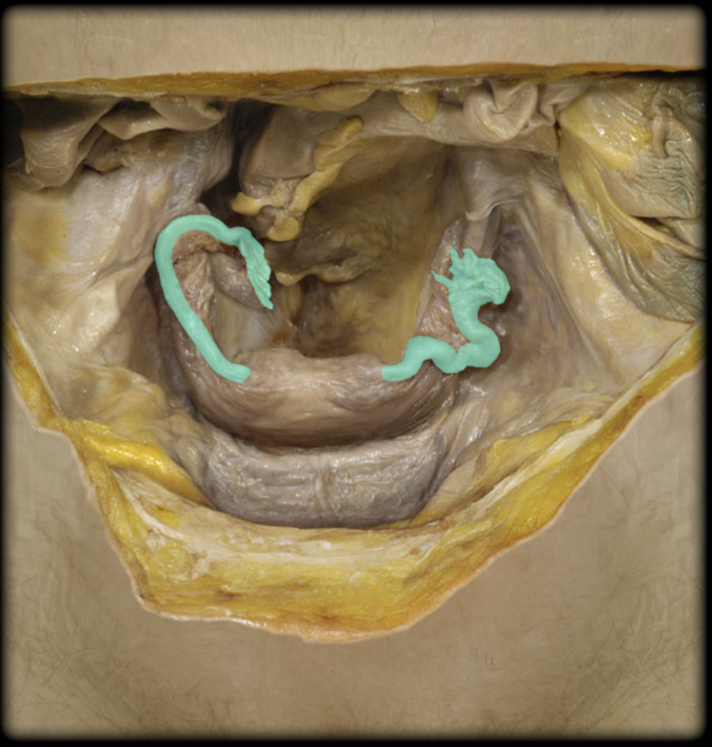 <p>What structure is shown?</p>