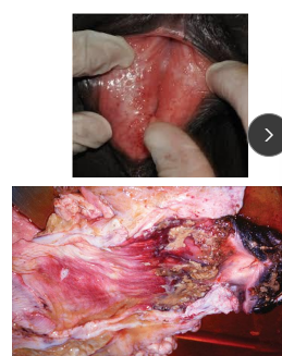 <p>Necrotic Vaginitiss in <span style="color: rgb(115, 90, 90)">ruminants</span></p>