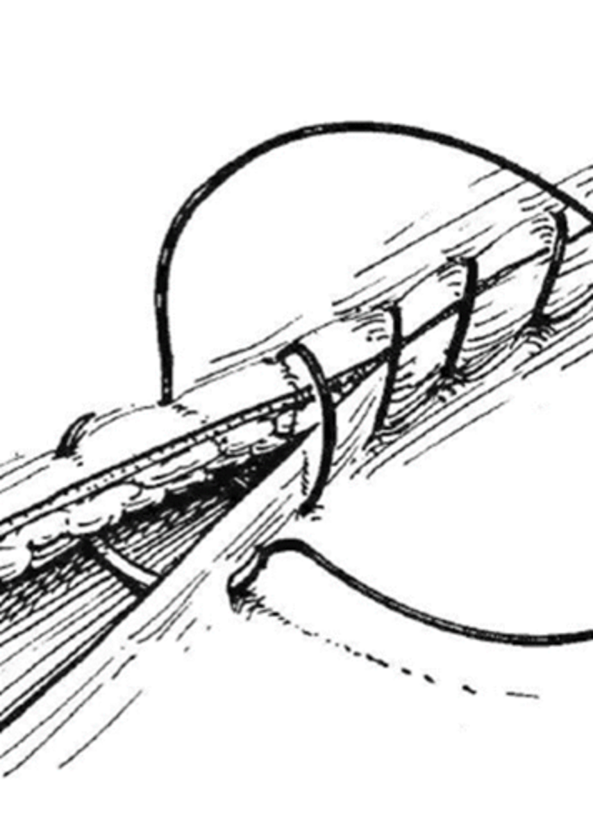 <p>appositional, tied off only at ends, saves time and suture material, not generally used for skin, avoid over-tightening, provides secure closure</p>