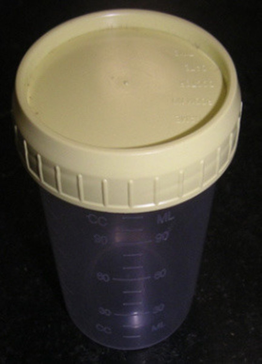 <p>A cup to place urine for testing with a lid for cover.</p>