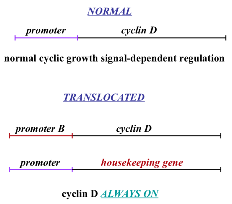 <ul><li><p><span>Normal</span></p><ul><li><p><span>C-myc binds to promoter and causes transcription of cyclin D mRNA and this only happens if c-myc is activated which occurs after a growth signal is detected&nbsp;</span></p></li></ul></li><li><p><span>Translocated</span></p><ul><li><p><span>In the process of DNA duplicating we have enzymes in our nucleus that cut and move DNA around..this can be a good thing (a way of adapting)...</span></p></li><li><p><span>Cell copies DNA but modifies it so now you have 2 proteins and lets say one is a housekeeping gene (meaning the promoter for it is always on/available) because with housekeeping genes we want to always be making it (me make it slowly and get rid of it slowly - related to half life - talked about earlier)&nbsp;</span></p></li><li><p><span>If during DNA duplication and we take the promoter from cyclin D and we put it on this housekeeping gene (which is on a different chromosome - possibly) and we take that promoter and put it in the cyclin D…this means the housekeeping gene is regulated by growth signals meaning it can be turned on and off the way cyclin D is suppose to be… the problem in this case is that cyclin D then becomes active all the time because it no longer needs a growth signal to start a cell cycle…that is cancer&nbsp;</span></p></li><li><p><span>This can be done with other proteins e.g. p27 or E2f or cyclin E&nbsp;</span></p></li><li><p><span>Can we do this switch with a 'brake’ pedal and prevent cancer or slow it down&nbsp;</span></p></li></ul></li></ul><p></p>