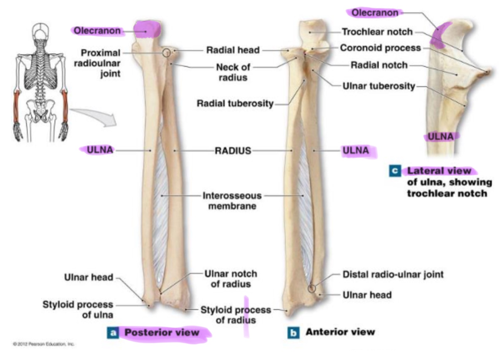 <p>large, curved projection on posterior side of proximal ulna; forms tip of elbow & fits into the olecranon fossa of humerus wehn arm is extended. it serves as an attachment site for triceps brachialis muscle</p>