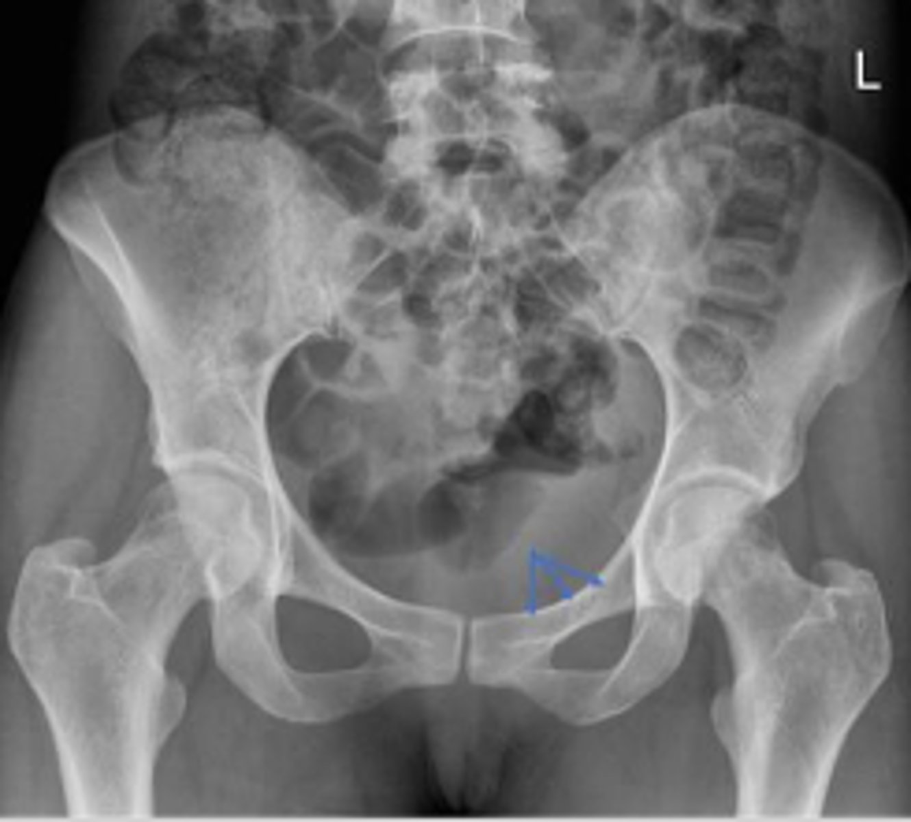 <p>What are the arrows pointing to?</p>