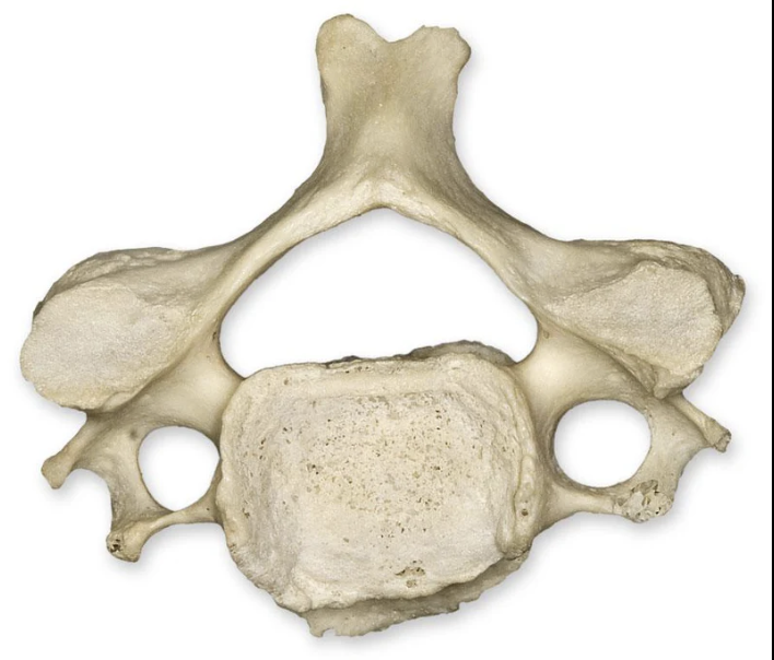 <p>What vertebrae is this?</p>