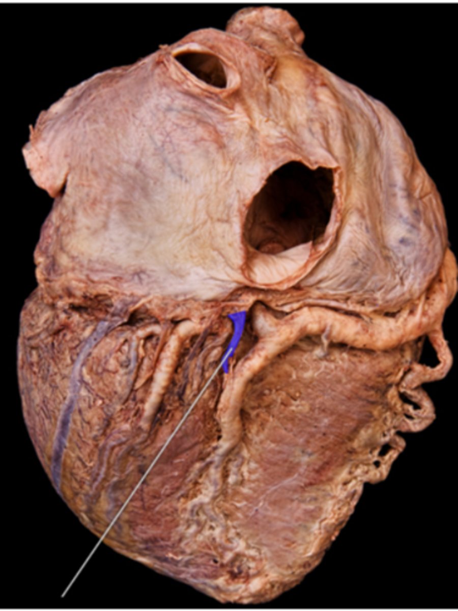<p>middle cardiac vein</p>