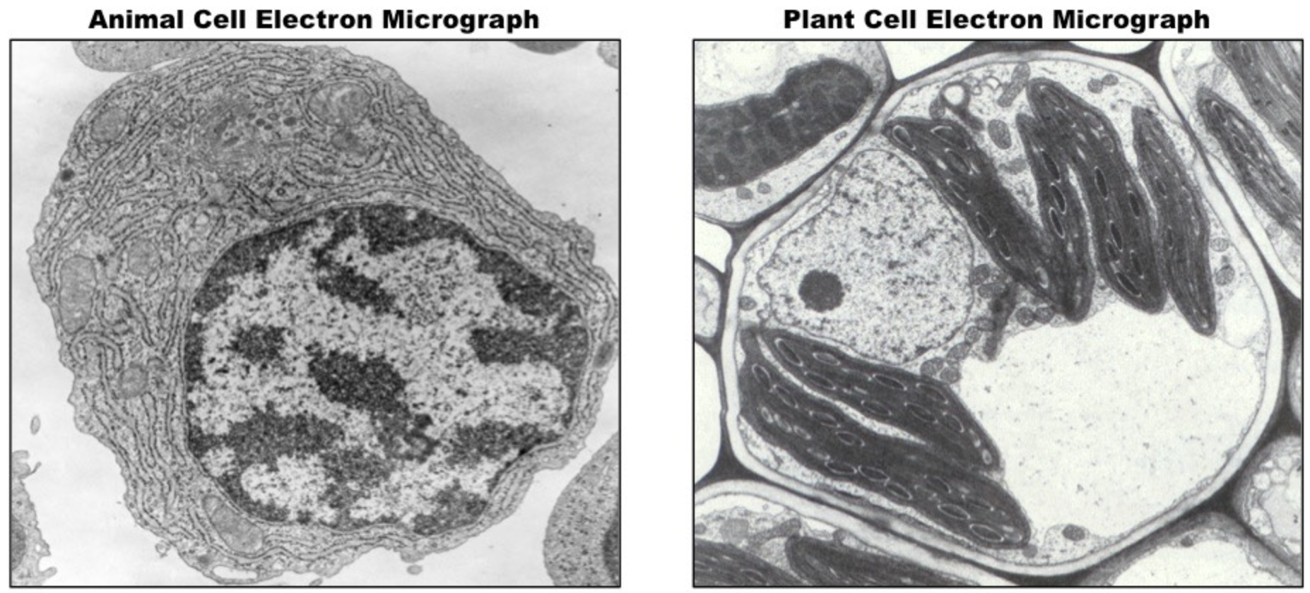 <p><strong>Eukaryote Micrograph: </strong>Chloroplast</p>