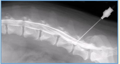 <p>Speed is essential during myelography as the contrast media is .. </p>