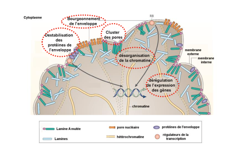 <ul><li><p>Exemple : <strong>mutation de la lamine A</strong> → <strong>syndrome de Hutchinson-Gilford (HGPS)</strong>, vieillissement précoce.</p></li><li><p>Mécanismes possibles :</p><ul><li><p>Déstabilisation des protéines de l’enveloppe nucléaire</p></li><li><p>Bourgeonnement anormal de l’enveloppe</p></li><li><p>Clustering des pores nucléaires</p></li><li><p>Désorganisation de la chromatine</p></li><li><p>Dérégulation de l’expression des gènes</p></li></ul></li></ul><p></p>