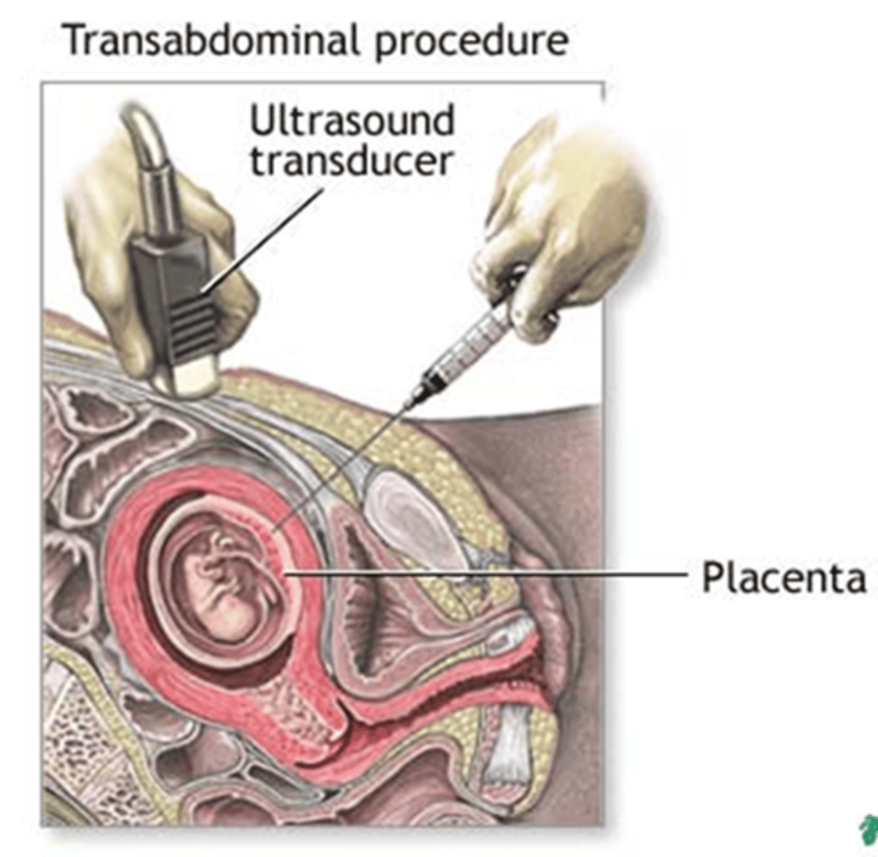 <p>1st Trimester at 10-13 weeks</p>