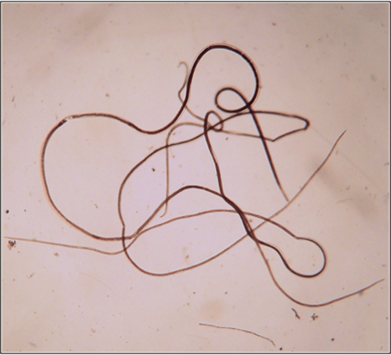 <p>Found in a chicken crop with inappetence and decreased egg production. What parasite is this?</p>