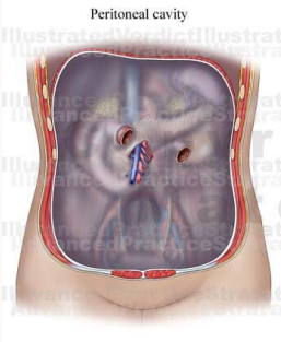 <p>The fifth layer of the abdomen, directly above the kidneys, is the _________. This cavity covers all of the retroperitoneal organs and structures. </p>