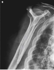 <p>What type of projection, position and anatomy is this?</p>