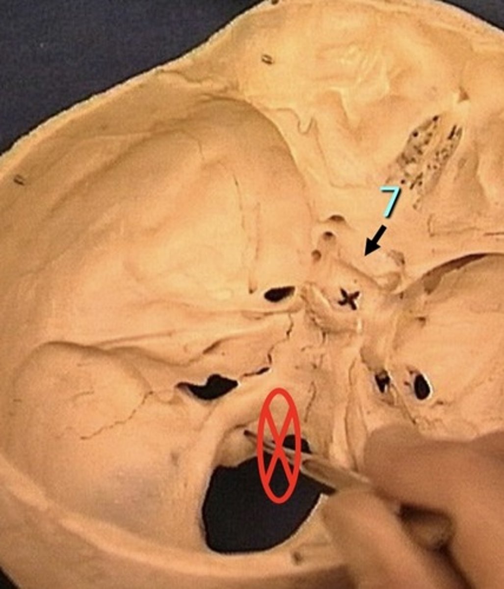 <p>1. Connects the 2 optic nerves of the eye</p>