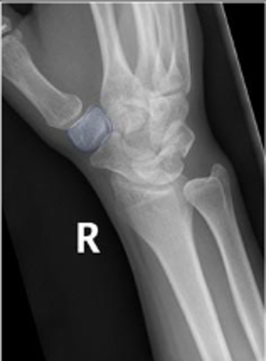 <p>What is outlined?</p>